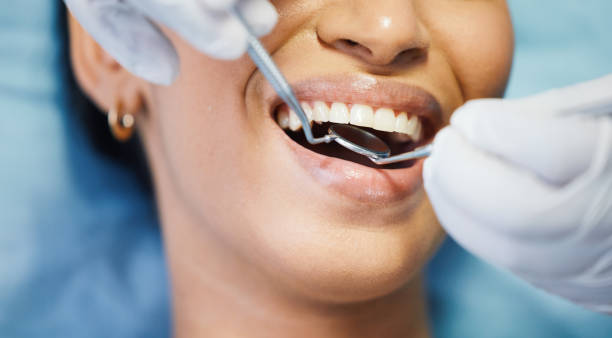 Best Emergency Dental Care for Broken or Chipped Teeth in Westfield Center, OH